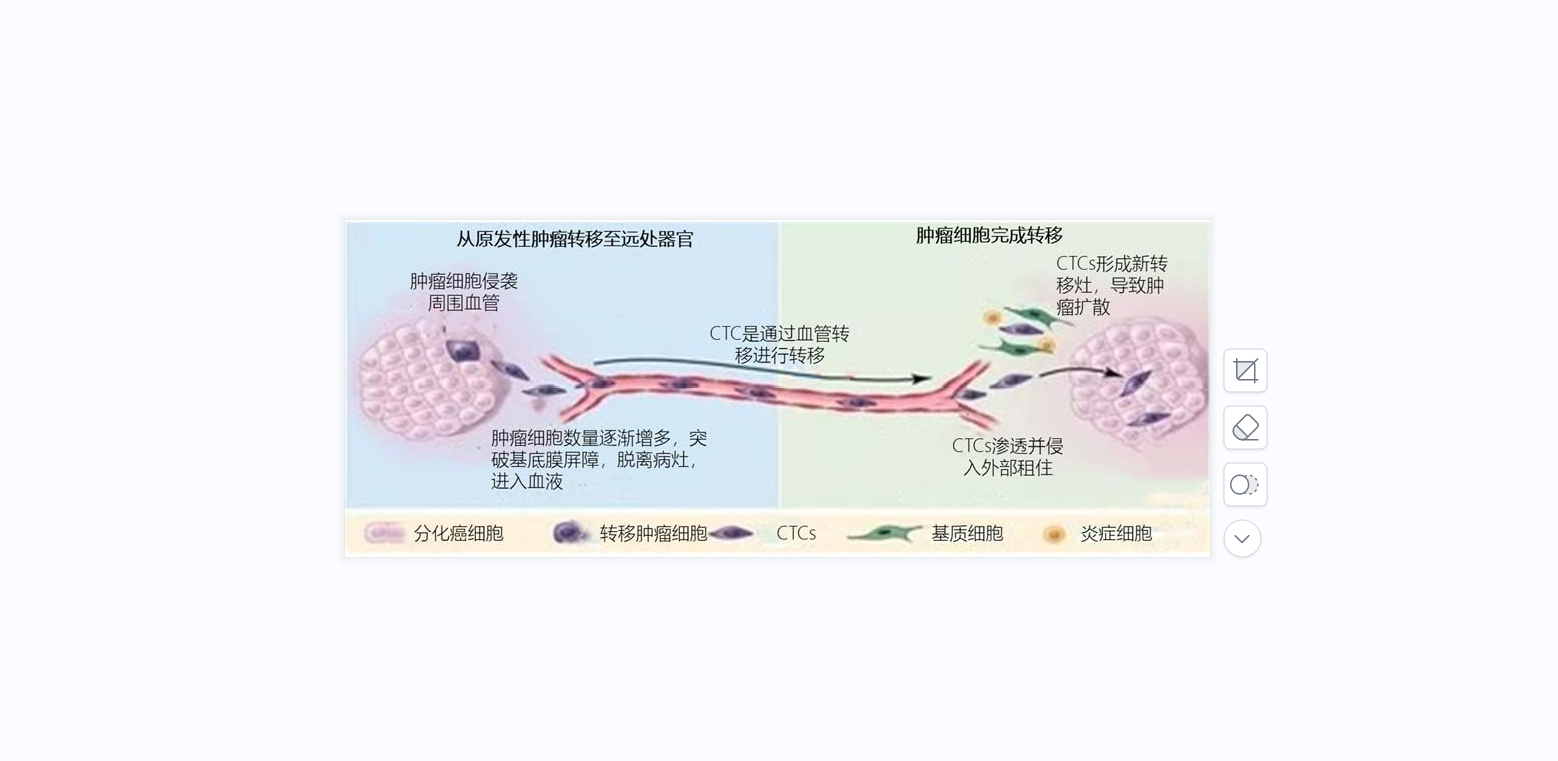 循環(huán)腫瘤細(xì)胞（CTC）簡讀